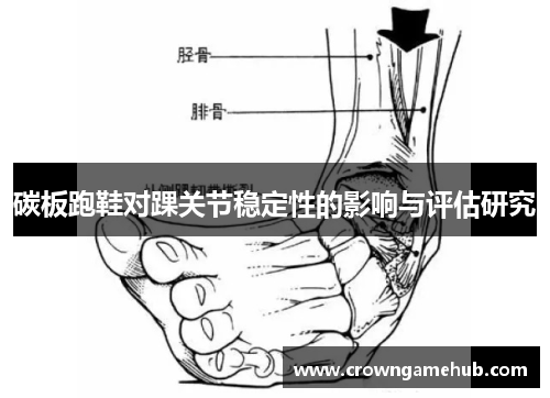 碳板跑鞋对踝关节稳定性的影响与评估研究